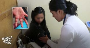 La ‘enfermedad de las ampollitas’ en manos, pies y boca se expande: 199 niños infectados en Huancayo