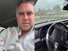 RAFAEL BELAUNDE DENUNCIA ATAQUE A BALAZOS EN PLENA CAMPAÑA