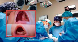 Casi el 98% de niños en Ayacucho presenta caries y autoridades refuerzan prevención al inicio del año escolar