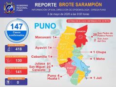 Sarampión en Puno sube a 147 casos y Juliaca concentra 81 contagios